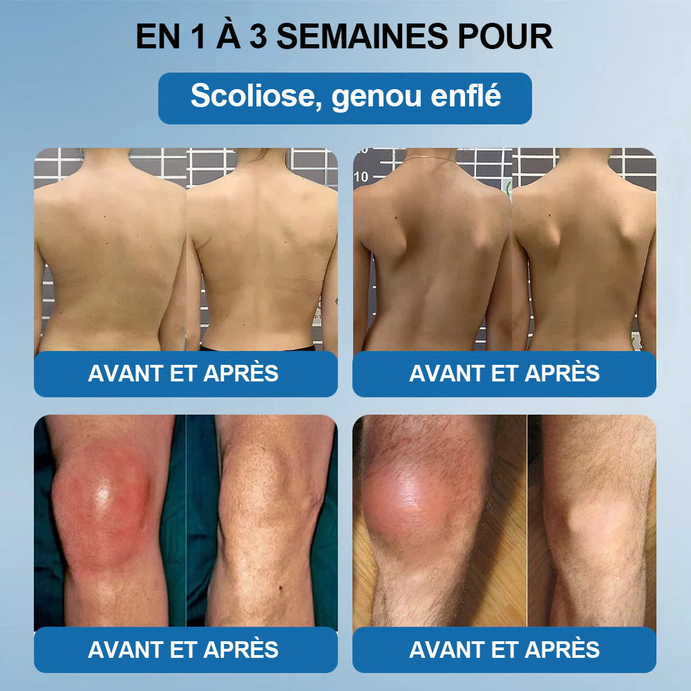 💖🦿𝖯𝗂𝖼𝗱𝗼® BPC-157 Crème de Réparation des Articulations 🦴 Traite l'arthrite, la neuropathie, le rhumatisme, les blessures sportives et bien plus