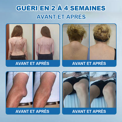 💖🦿𝖯𝗂𝖼𝗱𝗼® BPC-157 Crème de Réparation des Articulations 🦴 Traite l'arthrite, la neuropathie, le rhumatisme, les blessures sportives et bien plus