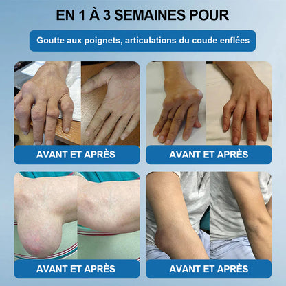 💖🦿𝖯𝗂𝖼𝗱𝗼® BPC-157 Crème de Réparation des Articulations 🦴 Traite l'arthrite, la neuropathie, le rhumatisme, les blessures sportives et bien plus