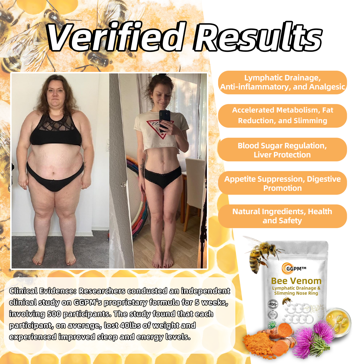 🐝Bee Venom Lymphatic Drainage & Slimming Nose Ring⭐(for all lymphatic problems and obesity)