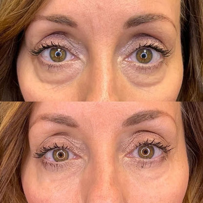 Anti-wrinkle Magic Eye Cream🔥BUY 2 GET 1 FREE🔥