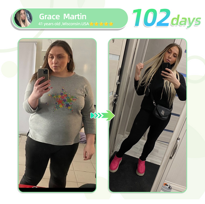 [See results in 7 days]🇬🇧 TLOPA® GLP-1 Nano Microneedle Patch👍(Painless, long-lasting, addressing diabetes, obesity, and cardiovascular diseases)🍃