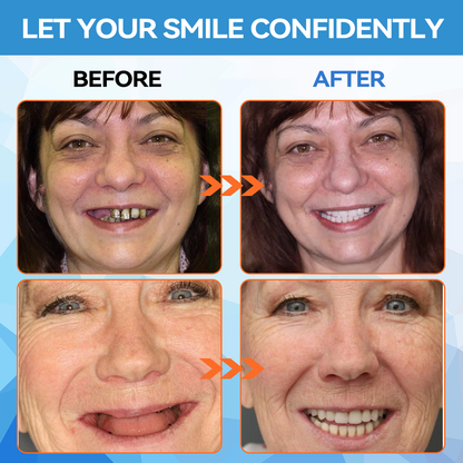 Official Store |Minceetbien™🗽 Moldable Dentures(⏰Limited Time 80% Off - Last 30 Minutes ⏰)