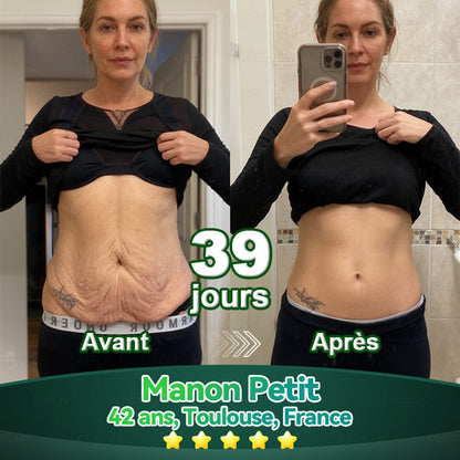 【Édition Exclusive Officiellement Autorisée】Lotmay® Sérum Oral de Cellules Souches et Peptides de Collagène 🛒(Raffermit et Tonifie la Peau Relâchée & Réduit la Formation de Rides）🌸