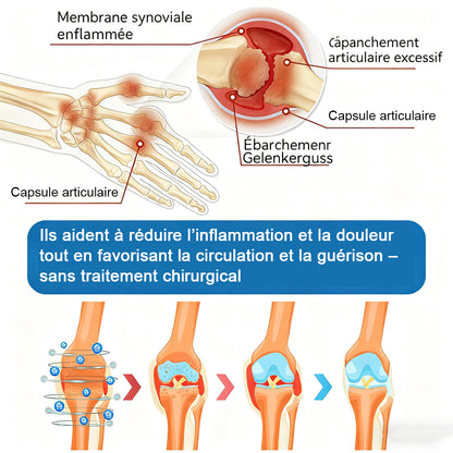 💖🦿𝖯𝗂𝖼𝗱𝗼® BPC-157 Crème de Réparation des Articulations 🦴 Traite l'arthrite, la neuropathie, le rhumatisme, les blessures sportives et bien plus